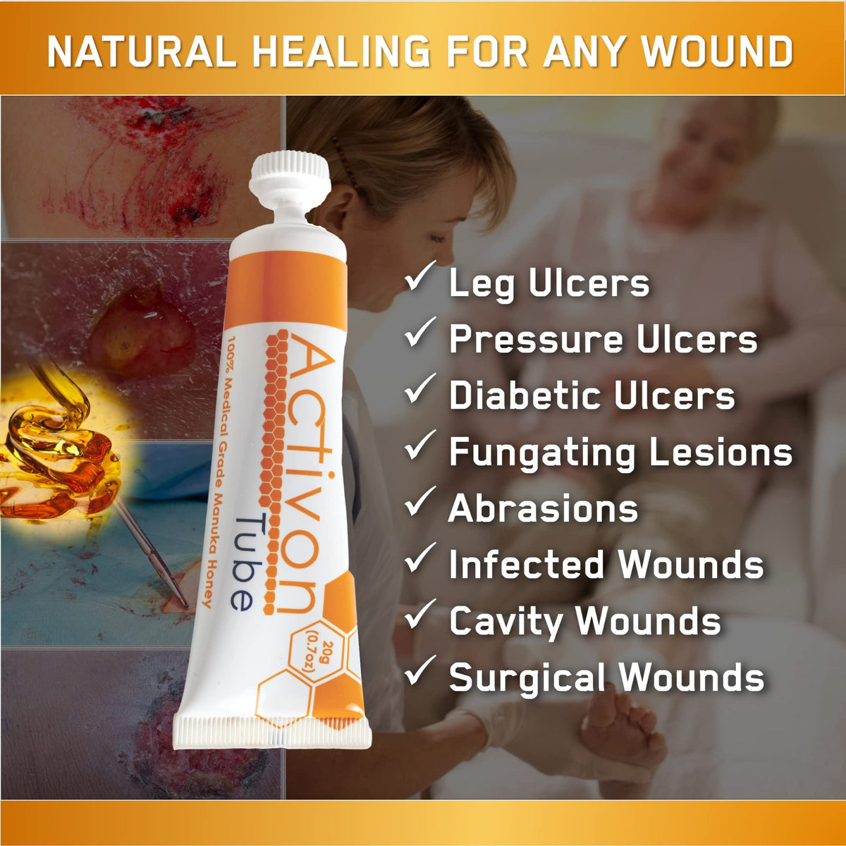 ActivOn wound dressing gel container setup showing sterile formulation