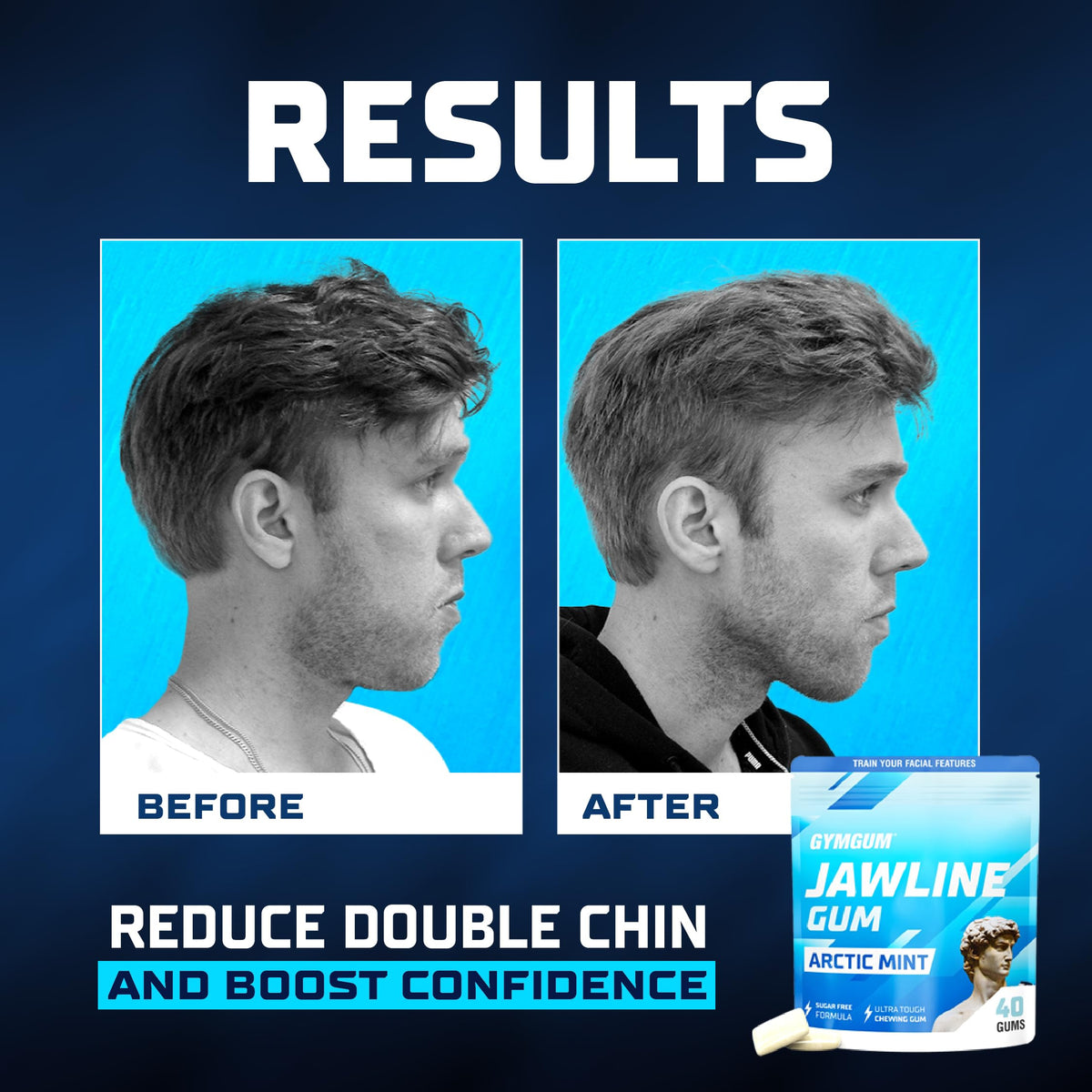 GYMGUM Jawline Gum side-profile view highlighting potential definition