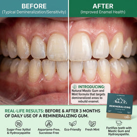 Royalee Remineralizing Gum packaging closeup showing clean, plant-based base.