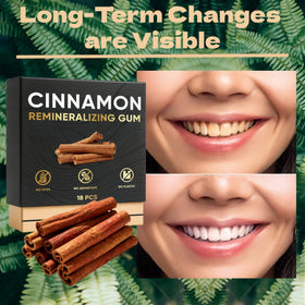 VOSETOKELA Remineralizing Gum with xylitol crystals signals sugar-free freshness.